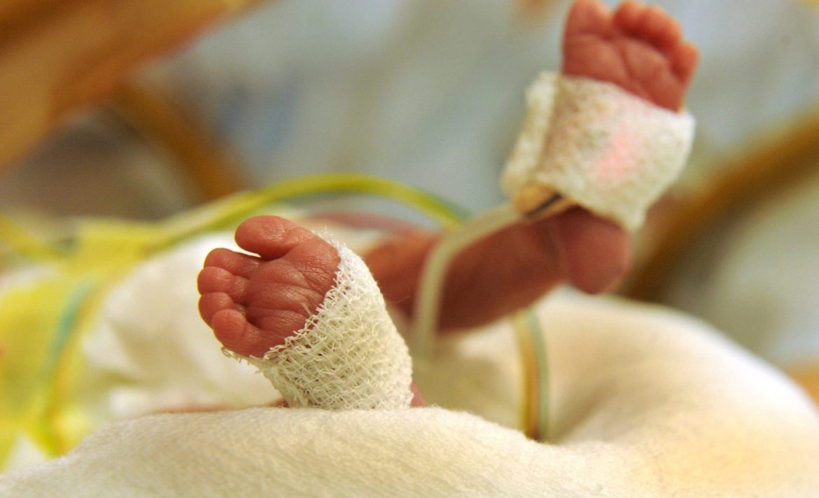 La prueba de Apgar: Evaluando la salud de los recién nacidos