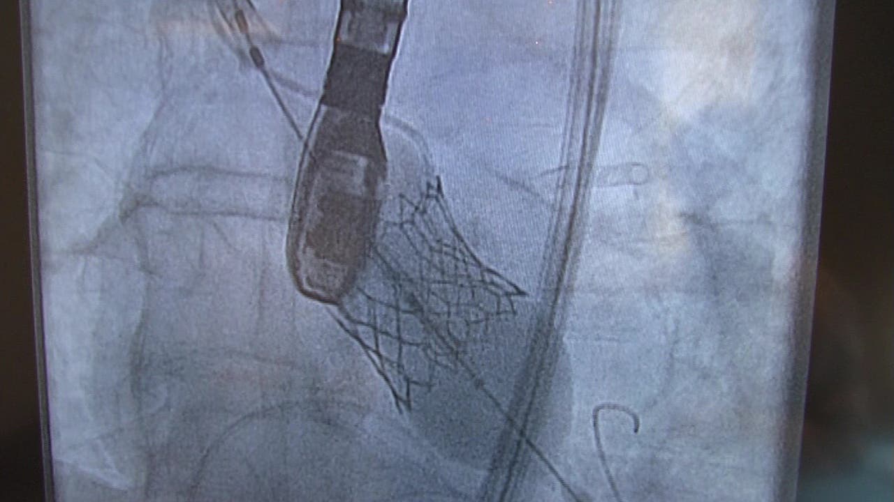Corazón