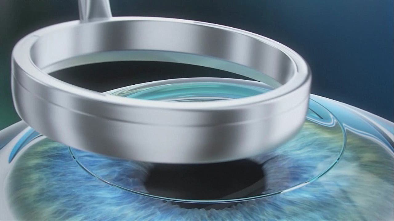 Dr. Jorge Alió del Barrio.