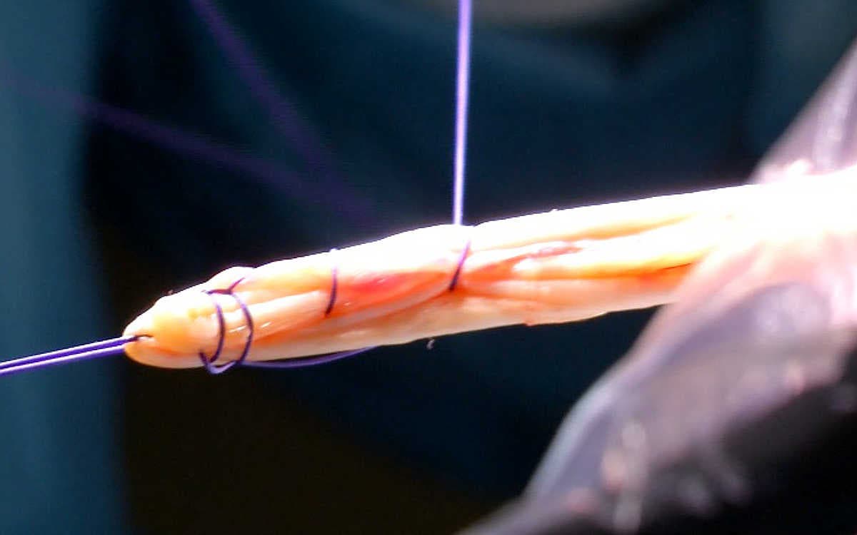 Localización del tendón pata de ganso-efe