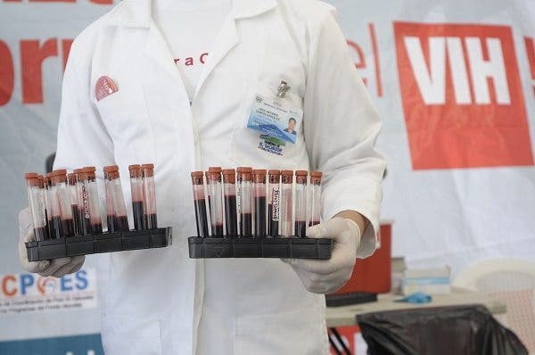 Personal de salud sostiene pruebas de sangre dentro de una campaña de prevención contra el sida en San Salvador (El Salvador).Efesalud.com