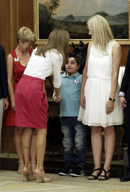 La reina Letizia, de espaldas, saluda a un niño afectado por la enfermedad conocida como "piel de mariposa" en la audiencia celebrada en el Palacio de la Zarzuela