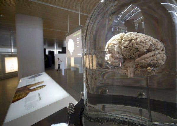 Detalle de un cerebro que se muestra en el Museo de la Evolución Humana inaugurado por la Reina Sofía hoy en Burgos.
