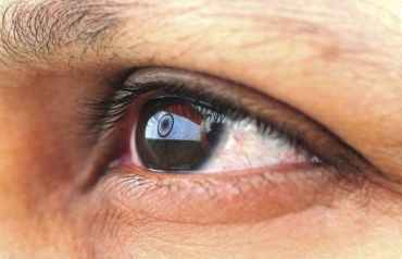 Frotar ojos riesgos problemas oculares