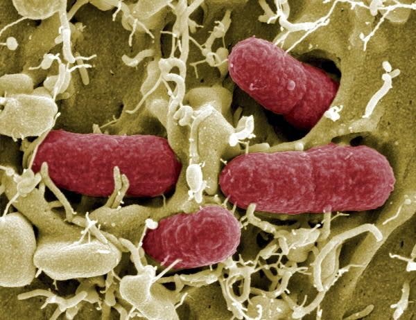 Descubierta en EEUU una “superbacteria” resistente a los antibióticos
