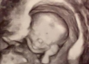 Bebé sonriendo en el útero de su madre