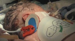 Bebé recién nacido en el quirófano para ser intervenido de una patología cardíaca-efe