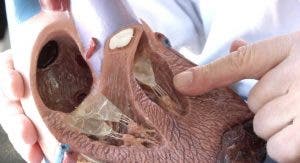 ventrículo izquierdo del corazón separado por un septo del ventrículo derecho.