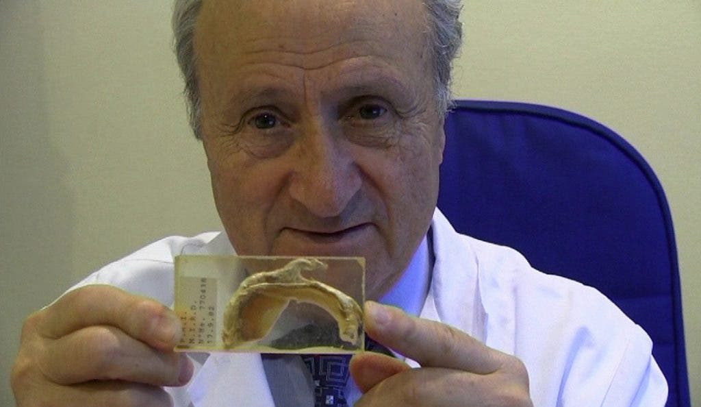 El doctor Pedro Guillén muestra un menisco completo de su colección permanente en el museo.