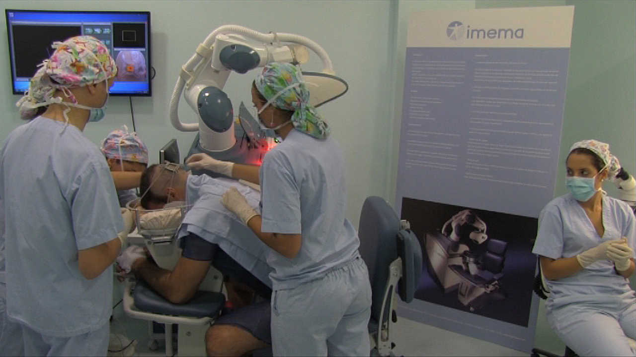 El equipo del doctor López Bran realiza un trasplante capilar robotizado.