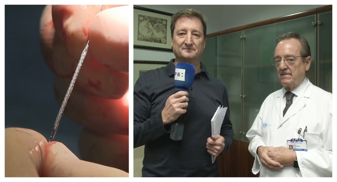 El Dr. Carlos Macaya nos muestra un estent coronario como recurso fotográfico para ilustrar una entrevista a EFEsalud