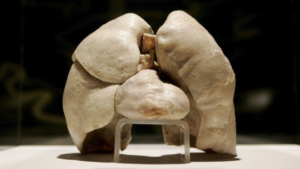 fotografía de un pulmón sano.