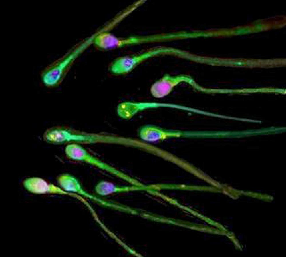 Varios espermatozoides humanos.
