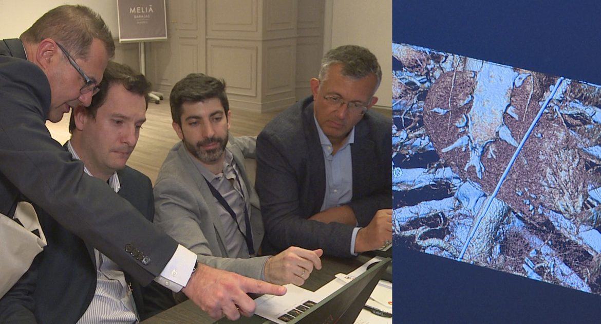 El cirujano cardiovascular, Miguel Ángel Gómez Vidal, señala a sus colegas de profesión un detalle del TAC de un tórax durante una intervención de sustitución de válvula aórtica.