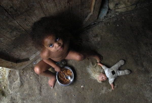 Cada día mueren 10.000 niños por desnutrición
