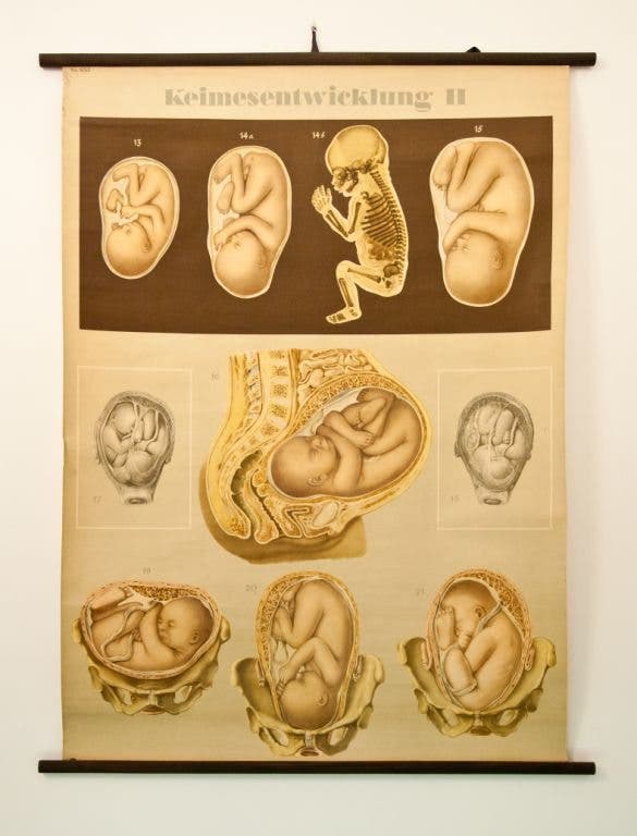 Imagen de la exposición temporal "Historia del parto"./ Cedida por la Real Academia Nacional de Medicina. 