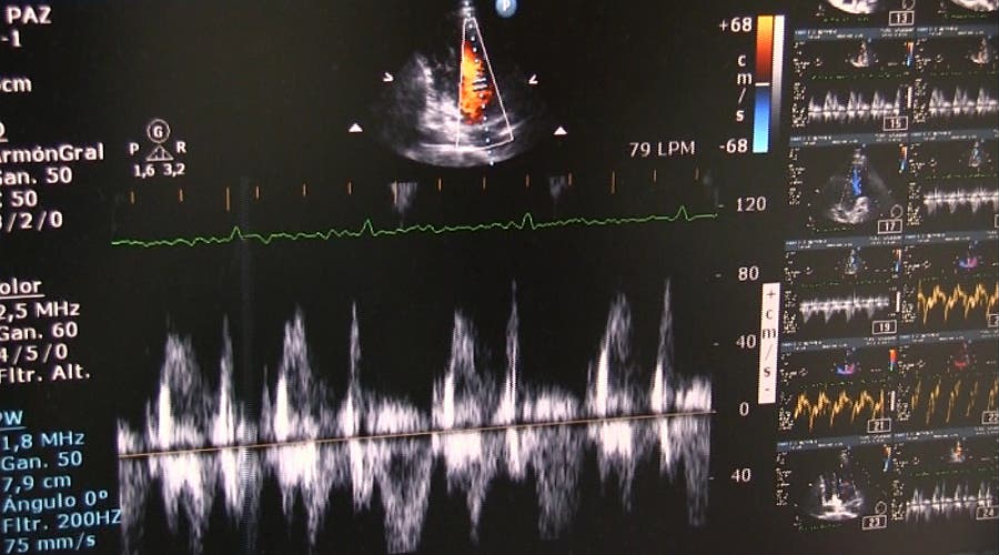Parámetros e imágenes del corazón registradas por un ecocardiógrafo.