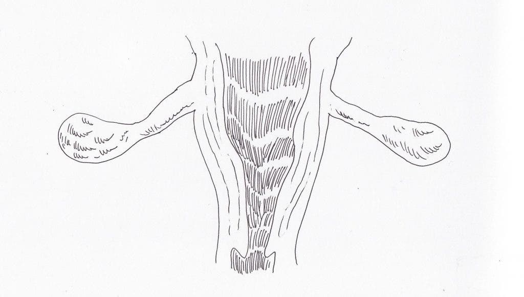 Dibujo de los dos ovarios y útero de la mujer para ilustrar el reportaje de los cánceres que sufre el sistema de reproducción femenino.