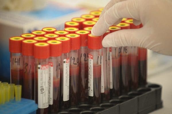 tumor hematológico