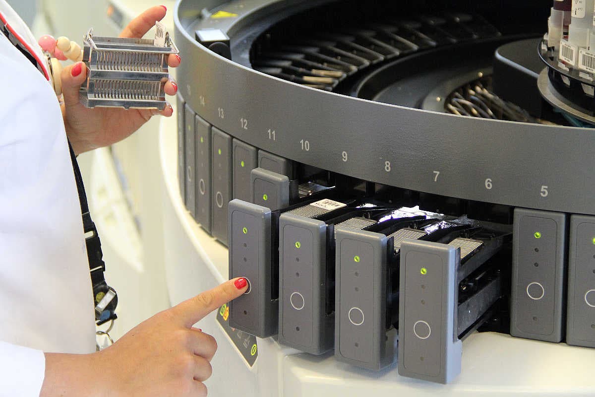 biopsia líquida mama