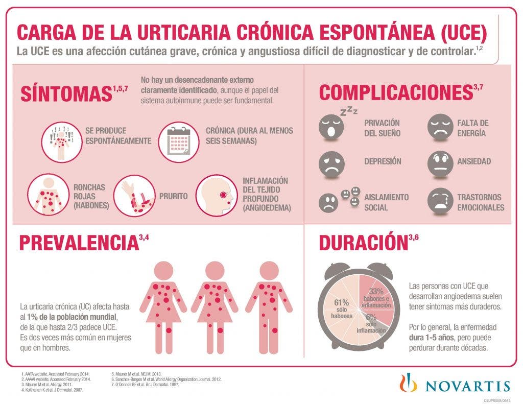 Infografía sobre la Urticaria crónica espontánea con la información que recoge el artículo.