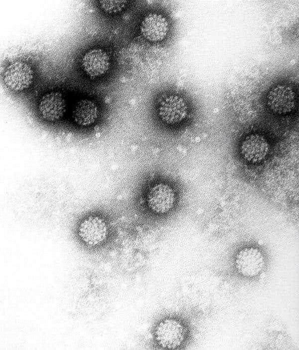 Imagen facilitada por el Instituto Alemán de Investigaciones sobre el Cáncer (DKFZ), que muestra una imágen del microscopio del virus del papiloma humano.