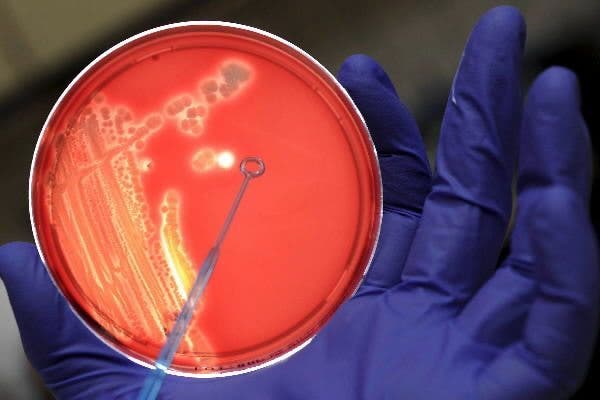Bacterias multirresistentes: Más de 35.000 muertos al año en España