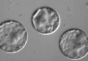 embriones humanos