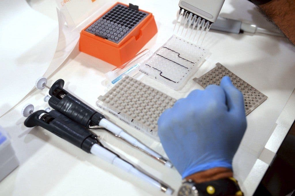 El Reina Sofía de Córdoba lleva años a la cabeza de los centros de España a la hora de diagnosticar y abordar enfermedades raras, para lo cual cuenta con una sección especializada en cribado neonatal, que analiza el genoma de los recién nacidos y posibilita el diagnóstico precoz de 30 enfermedades difíciles de detectar por otros medios. EFE/Rafa Alcaide