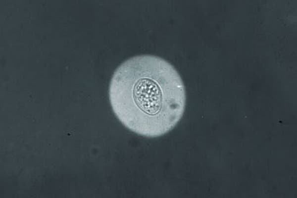 cryptococcus neoformans.tinta china-efe
