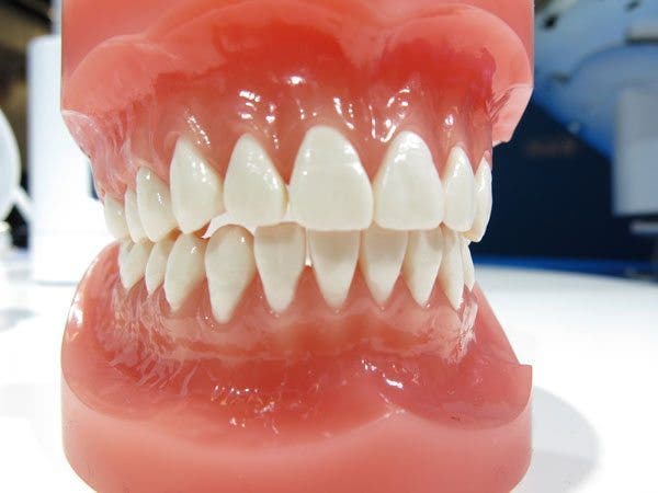 Injerto de encía, sujeción natural para los dientes