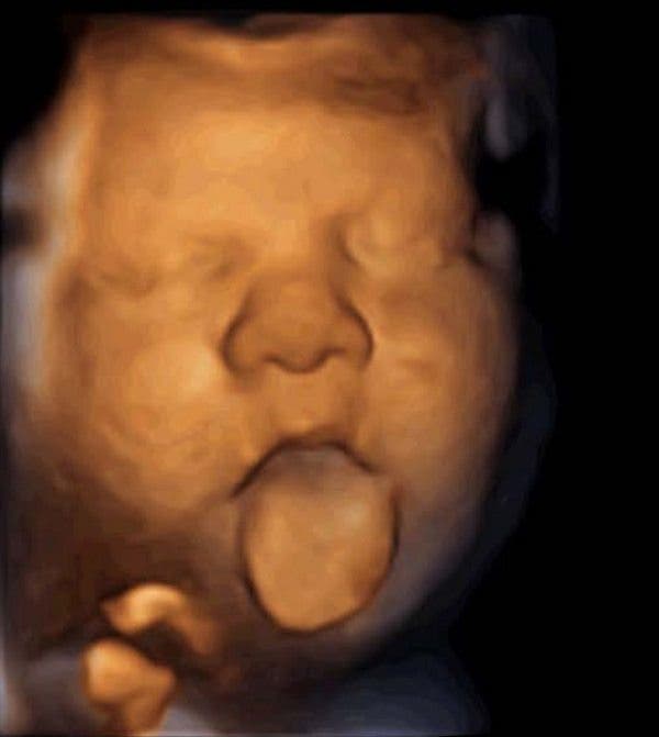 Imagen de feto durante el estudio “Expresión facial fetal en respuesta a la emisión de música vía vaginal”./ Imagen cedida por el Institut Marquès.