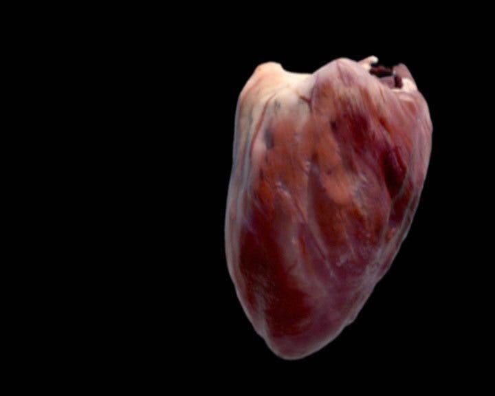 Primera simulación exacta de un corazón para probar terapias personalizadas
