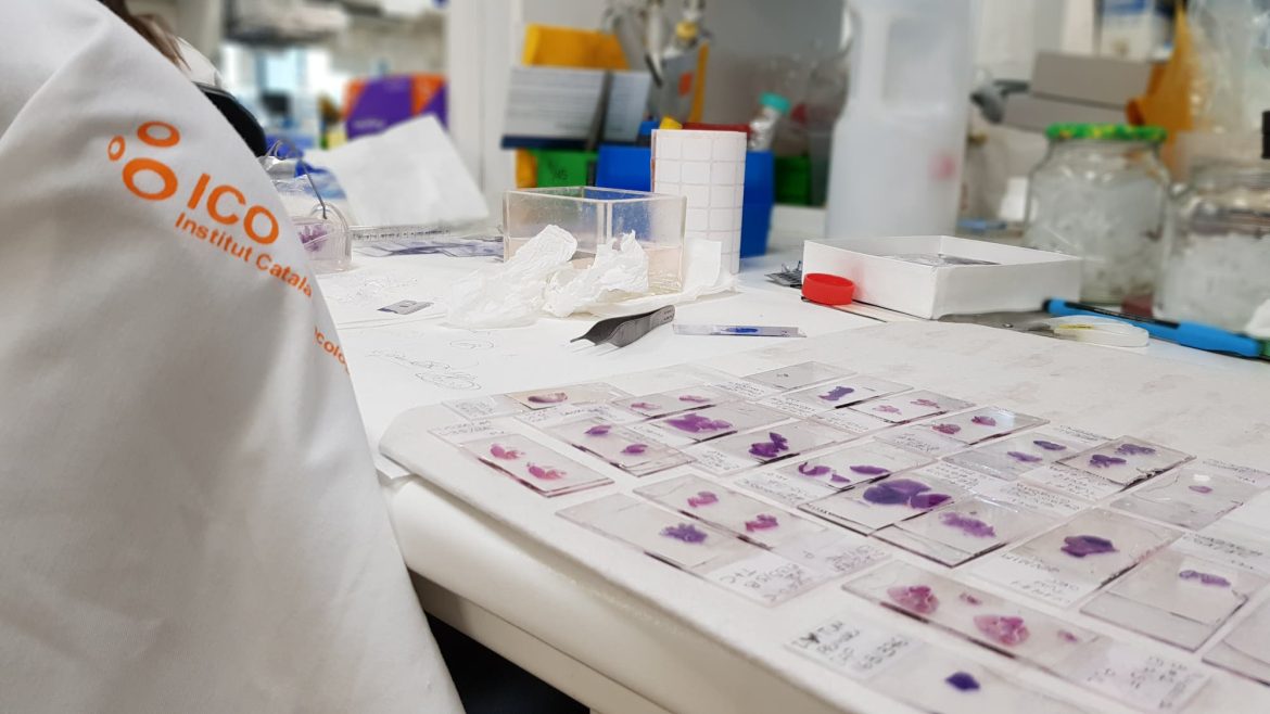 Investigación Instituto Catalán de Oncología