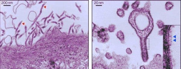 Cómo el virus Lloviu podría servir de vacuna contra su “primo” ébola