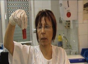 Investigadores españoles descubren una terapia que retrasa el mieloma