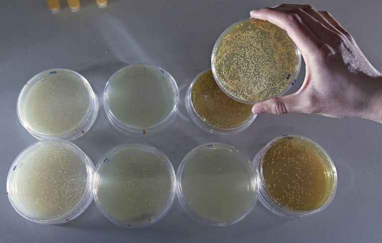 microbiología sujeta una placa con una muestra de probióticos.