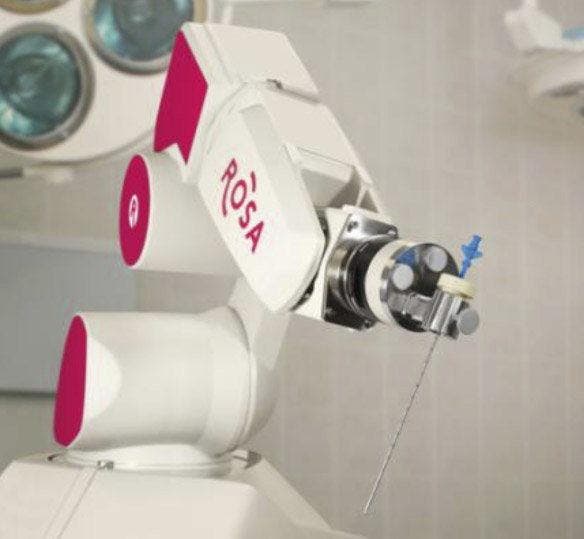 Un robot de medio kilo y electrodos de 1 mm para acorralar a la epilepsia