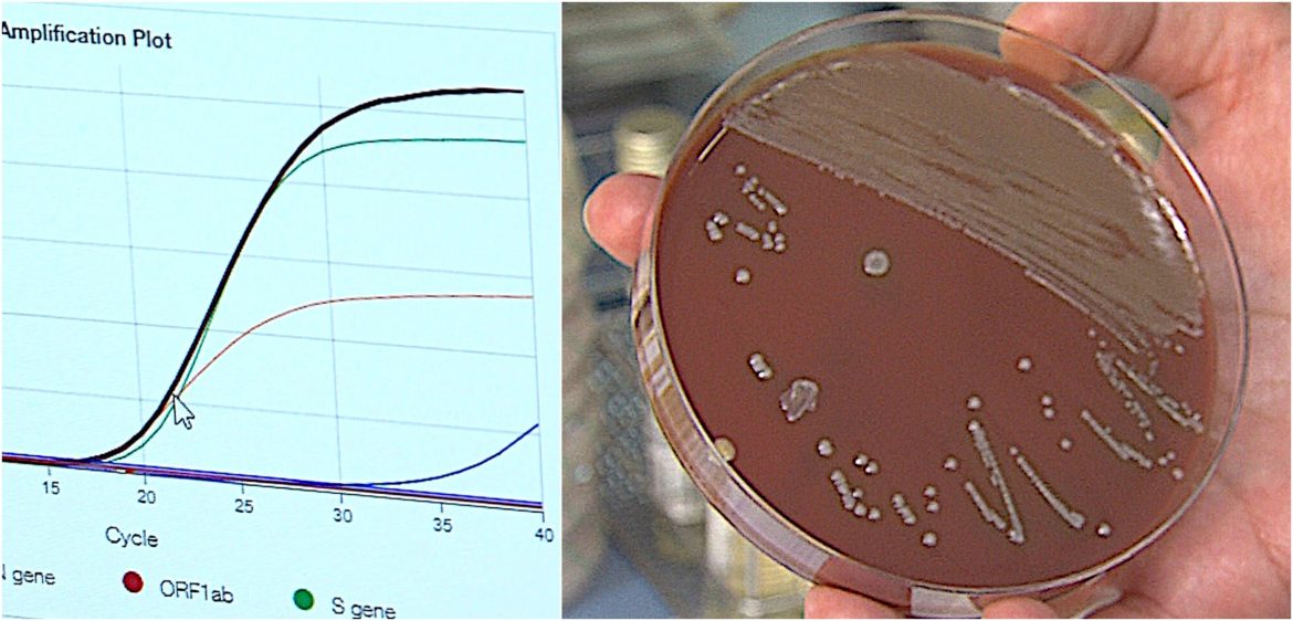 virus y bacterias_ microorganismos agentes de la neumonía-efe