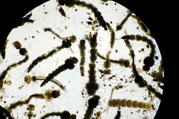 En la microcefalia por zika es determinante cuando se infecta la embarazada
