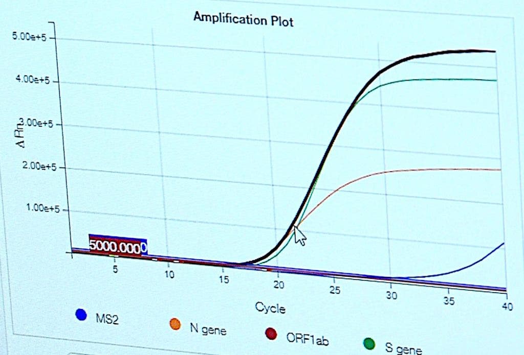 PCR positivo por SARS-CoV-2