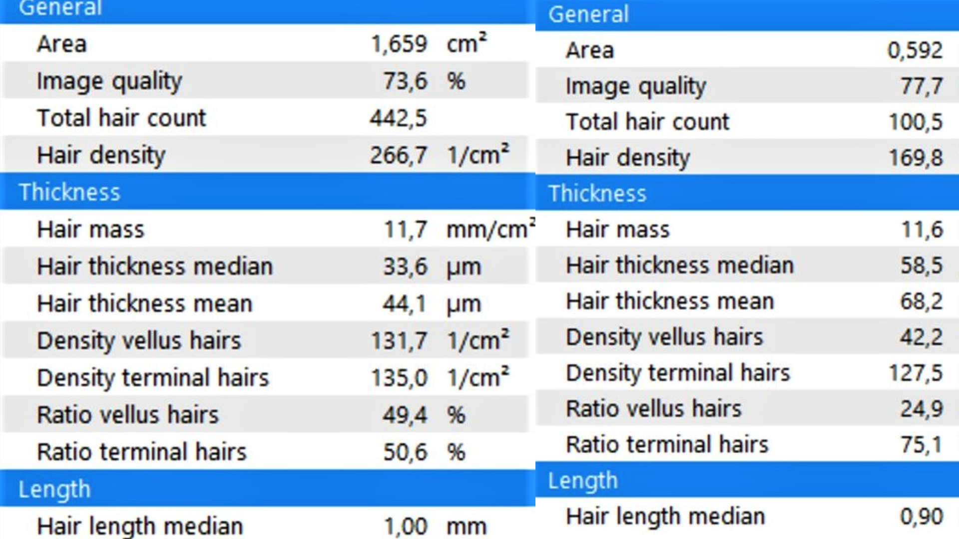 Parameters of the digital trichoscope on alopecia.