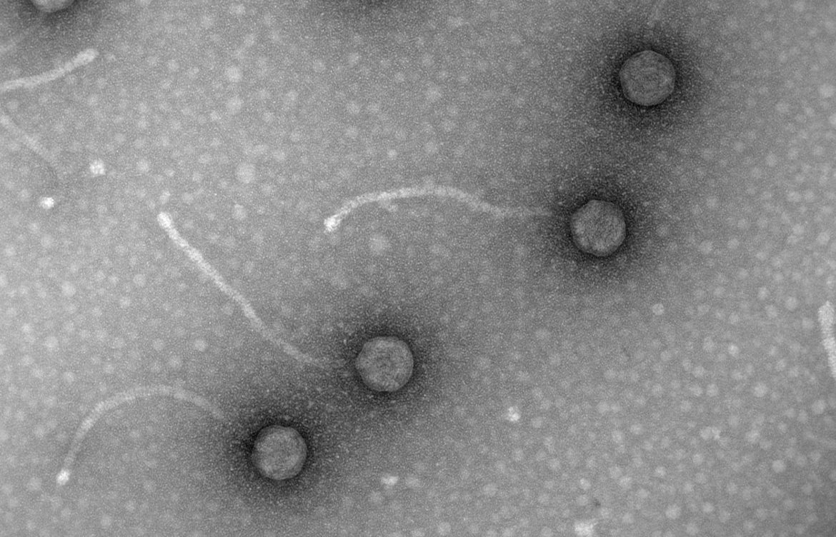 Fagos, los virus “come” bacterias para combatir la resistencia a los antibióticos