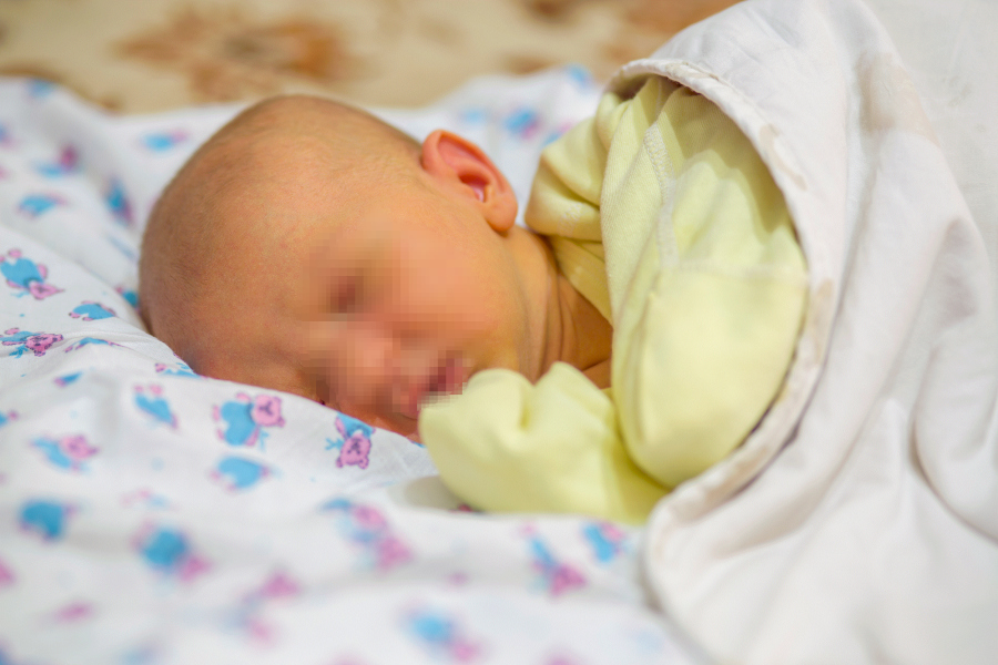 ¿Un recién nacido amarillo? Puede ser ictericia