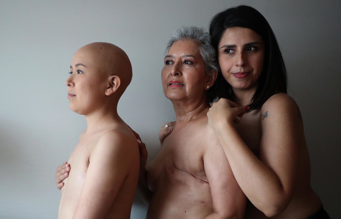 OMS: Una de cada 12 mujeres en el mundo desarrollará cáncer de mama