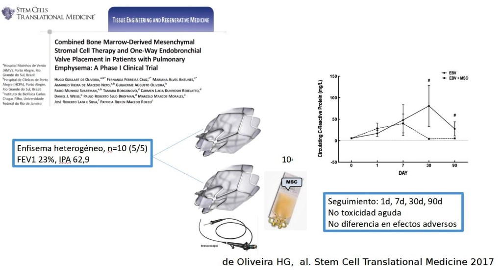 Células mesenquimales y epoc