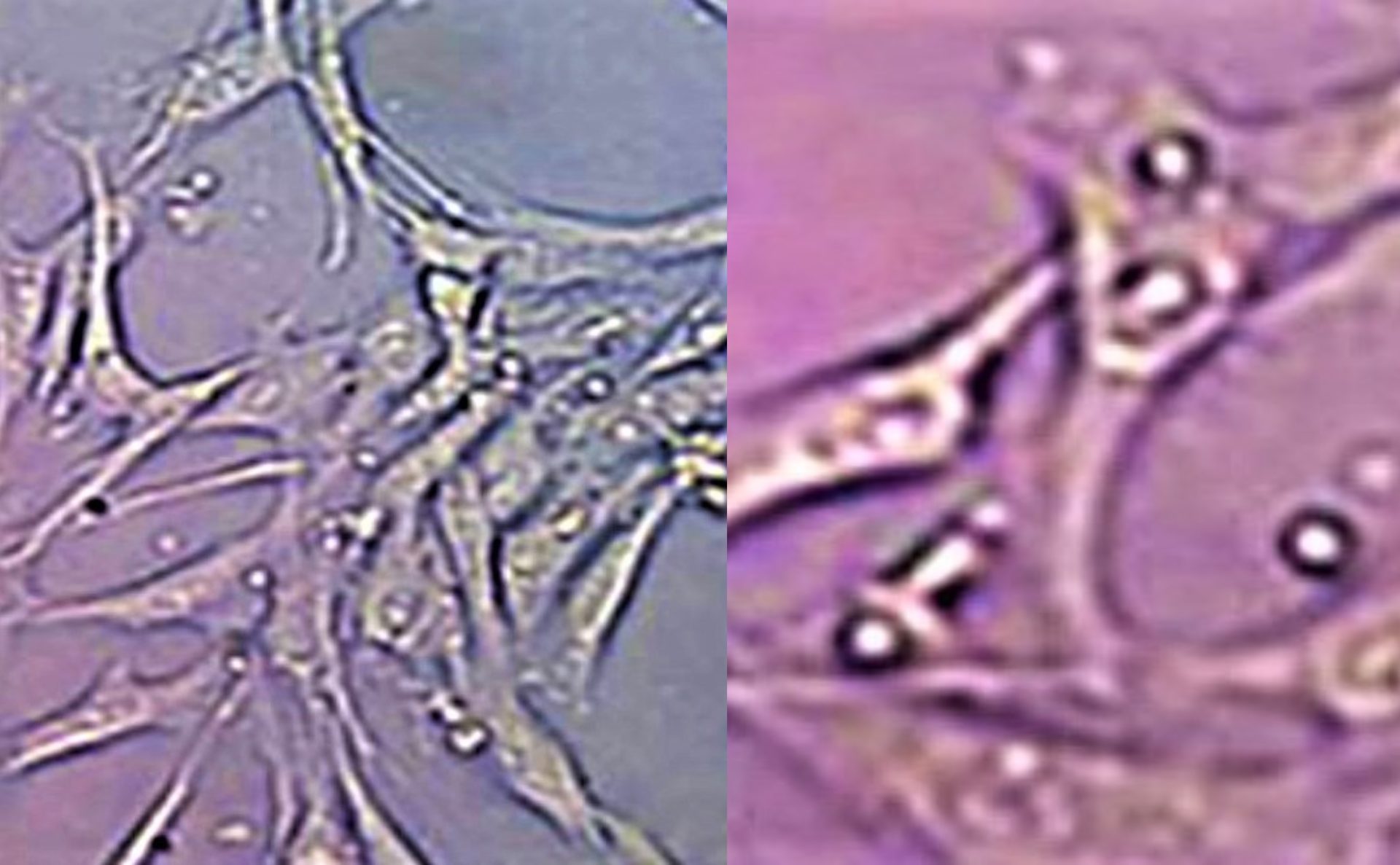 Células mesenquimales y epoc