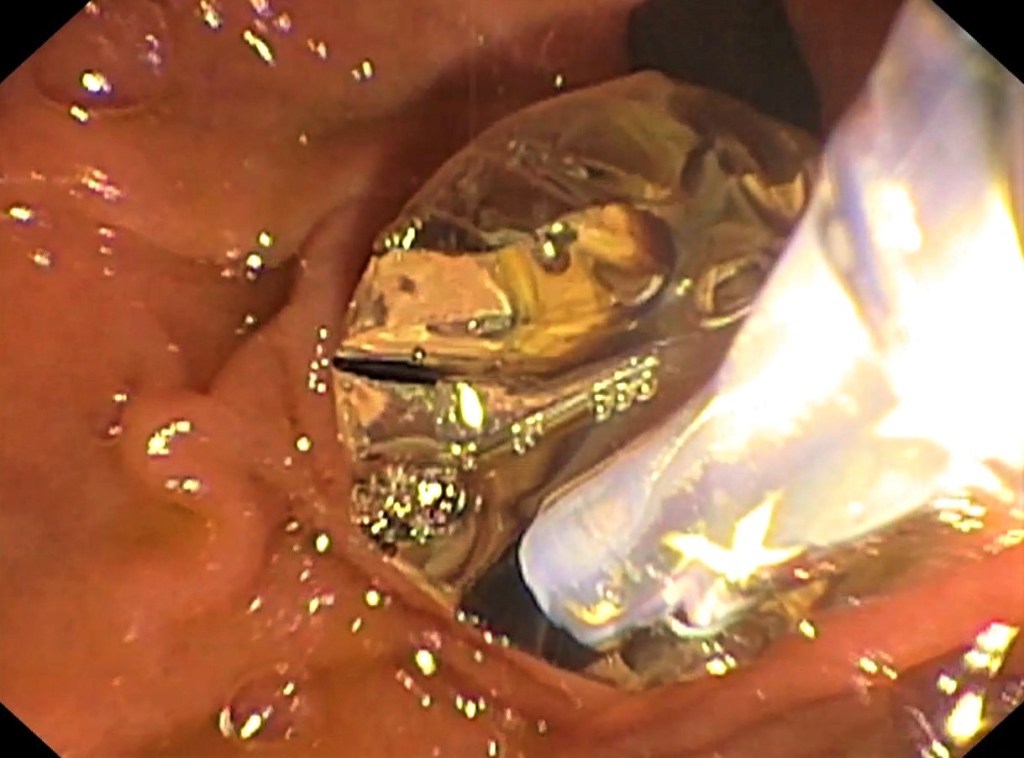 herramientas de la endoscopia.