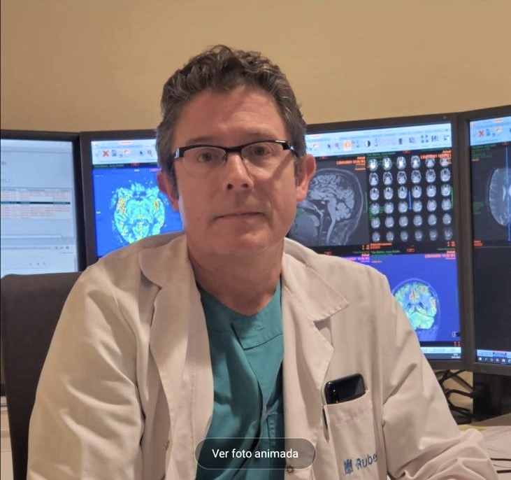 resonancia magnética párkinson
