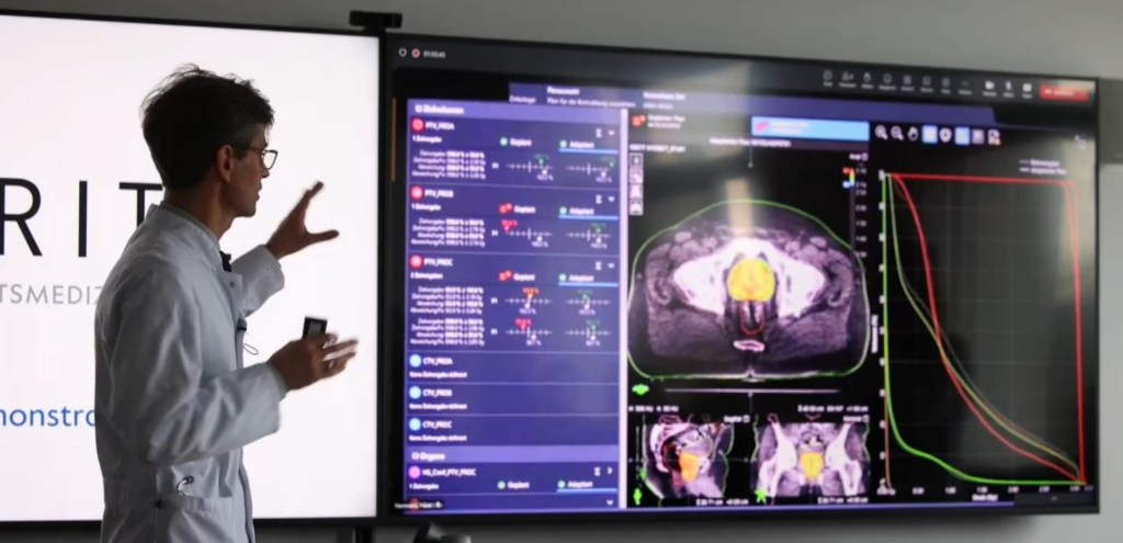 inteligencia artificial oncología